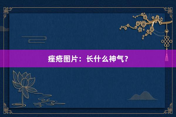 痤疮图片：长什么神气？